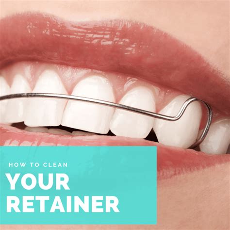 How to clean retainers by type. How to Clean Your Retainer