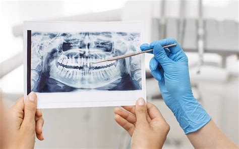 Ortopantomografía O Radiografía Panorámica Clínica Dental Vinateros