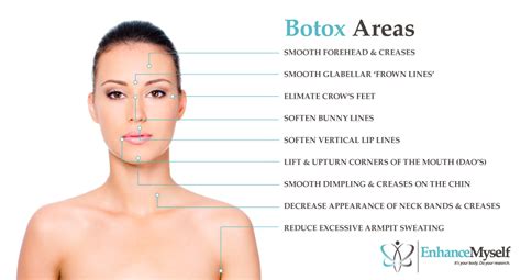 Botox Cost How It Works Uses Benefits Duration Of Results
