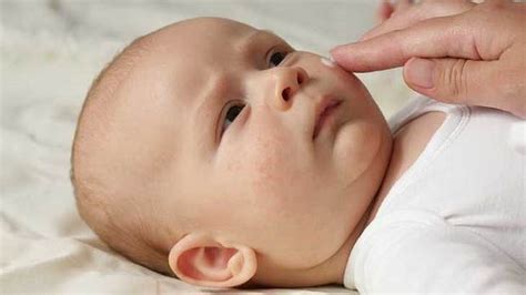 Cum Se Ingrijeste Pielea Bebelusului Cu Dermatita Atopica Bebelu Ro