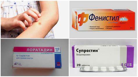 Рецепты аллергической диеты Аллергии на укусы комаров у детей и взрослых: симптомы и лечение Аллергии на укусы комаров у детей и взрослых: симптомы и лечение Рецепты аллергической диеты