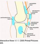 Knee Plica Treatment