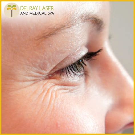 Causes And Risk Factors Of Wrinkles Delray Laser And Medical Spa