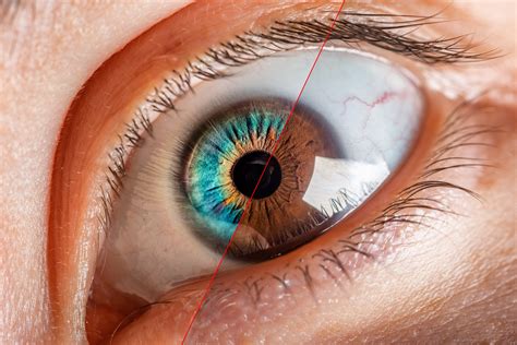 Genetyczne Choroby Oczu Dziedziczne Problemy Ze Wzrokiem Kliniki Okulistyczne Optegra