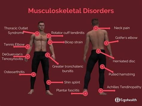 Musculoskeletal Disorders In The Workplace And Prevention