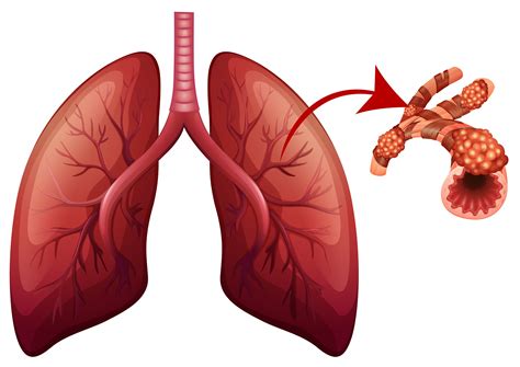 Lungs With Magnified Part Illustration 298336 Vector Art At Vecteezy