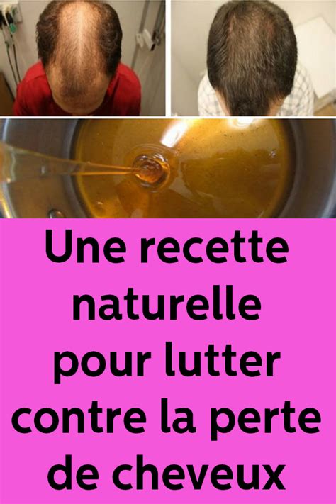 Une Recette Naturelle Pour Lutter Contre La Perte De Cheveux Perte De