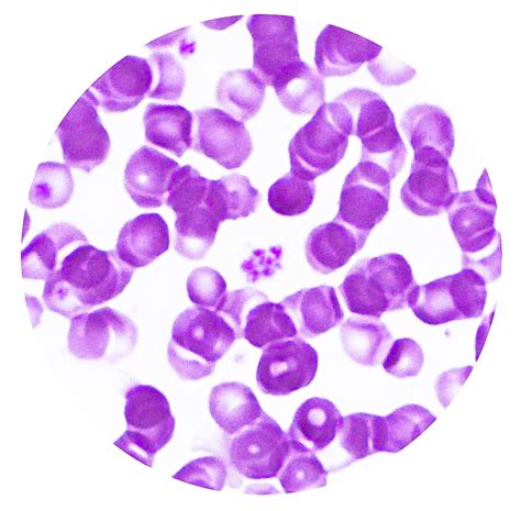 Platelets Histology And Histophathology