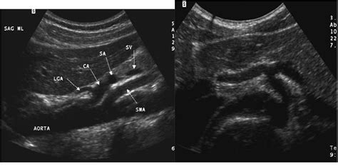 Pin By Danielle4567 On Abd Ultrasound 100 Mod 2 Diagnostic Medical