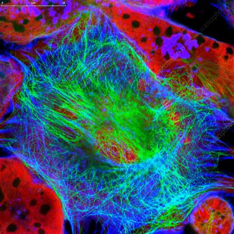 Neuroblastoma Cells Fluorescence Light Micrograph Stock Image C034