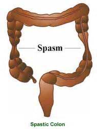 Or to separate groups of numbers. Spastic colon. Causes, symptoms, treatment Spastic colon