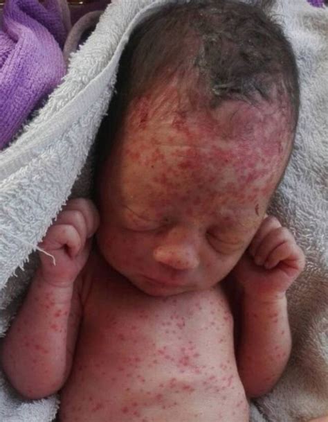 Newborn Baby Dumped In Field Found Covered In Ant And Mosquito Bites