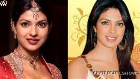 Bollywood Actresses With Plastic Surgerybefore And After Youtube