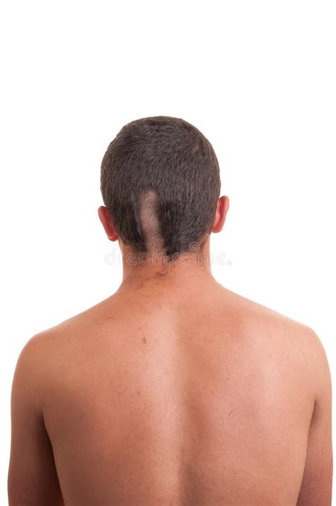 Balding Man S Head Stock Image Image Of Male Care Concepts 26966075