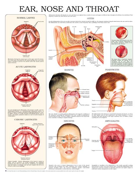 Ear Nose And Throat Diagram