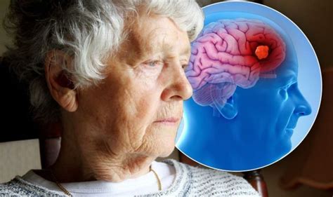 Four Of The Most Common Early Warning Signs Of Vascular Dementia Vascular Dementia Dementia