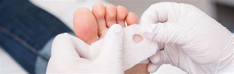 Chiropody And Podiatry Foot Care The Foot Care Group