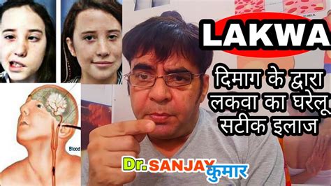 lakwa ka ilaj lakwa marna paralysis treatment symptoms and causes youtube