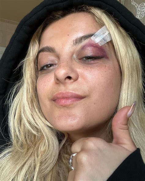 fan who threw phone at bebe rexha during nyc concert reveals reason