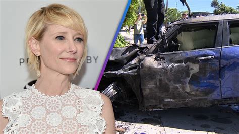 Anne Heche Car Crash Burn Specialist Explains Her Injuries