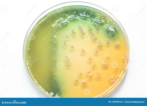 Pseudomonas Aeruginosa Bacteria On On Columbia Blood Agar Stock Photo