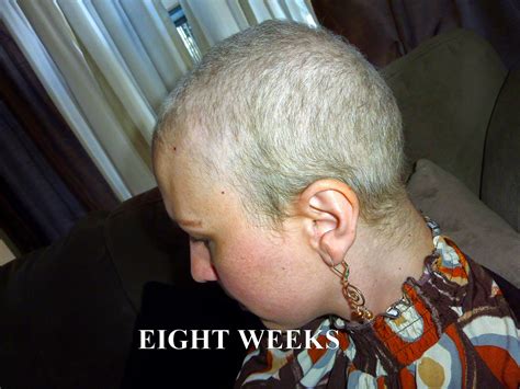 Anncredible Hair Growth Progression After Chemo Six Months With Update