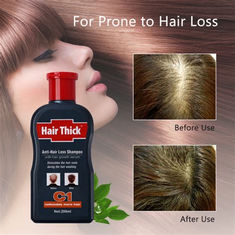 Anti Hair Loss Shampoo Thick Dexe 200ml C1 Hirix