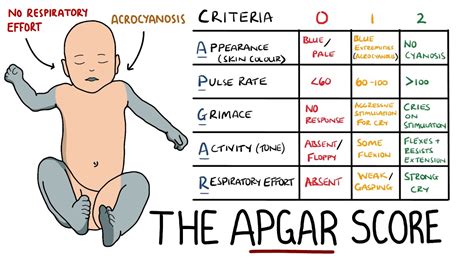 Apgar Test Understanding Apgar Score For Birth Injury Evaluation