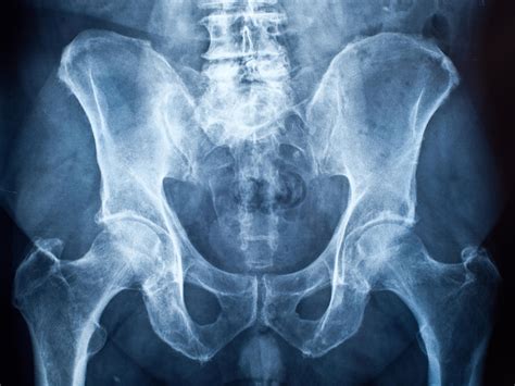 Humans Have No Penis Bone Because Sex Doesnt Last Long