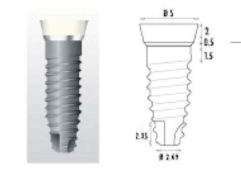 Tbr Z1 Conic Dental Implant Spotimplant