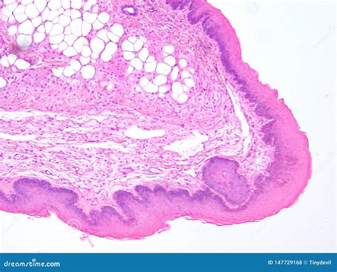 Histology Of Epiglottis Human Tissue Royalty Free Stock Image