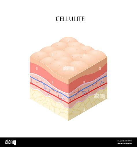 Cross Section Of Human Skin Layers Vector Image Stockunlimited Hot Sex Picture