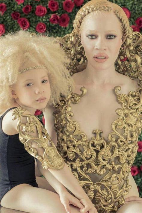 Albino African Americans Albino Model Albino Girl Black Women