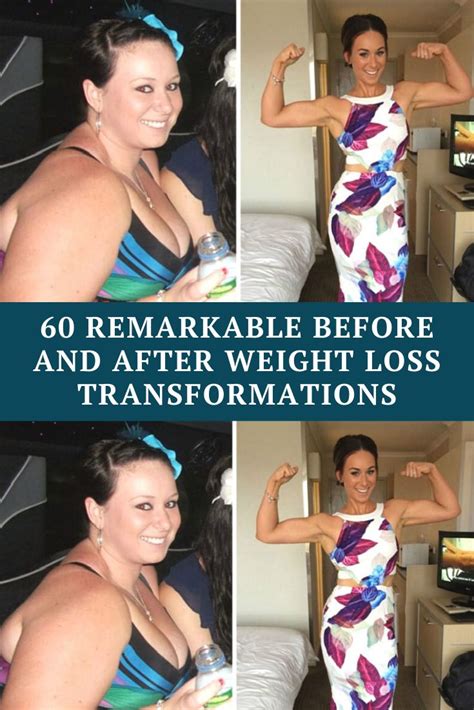 Pin On Before After Weight Loss Transformation