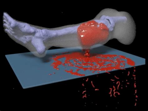 This Bleeding Gunshot Wound Animation Could Save Lives Business Insider