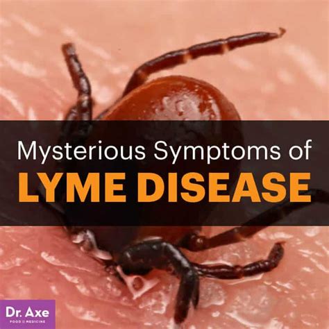 Lyme Disease Symptoms Causes And Facts Dr Axe