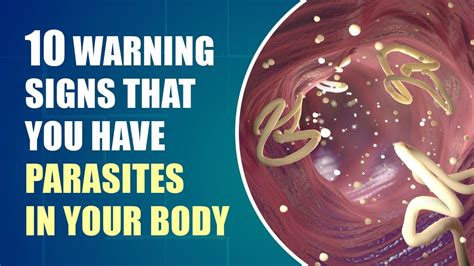 don t ignore these early symptoms of parasites in your body youtube