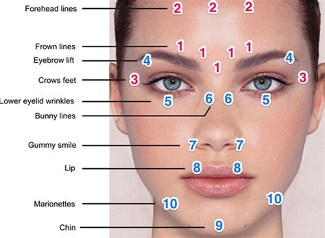 One of the most popular questions patients have is how often to get botox. Gallery For > Botox Eyebrow Lift Injection Sites | beauty ...