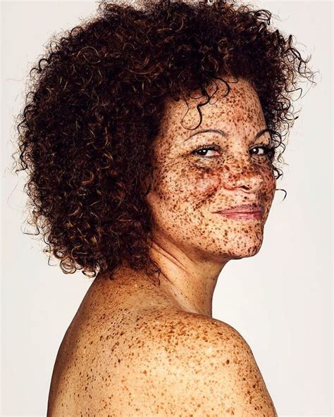 Photographer Takes Portraits Of Freckled People To Celebrate Their Unique Beauty Body