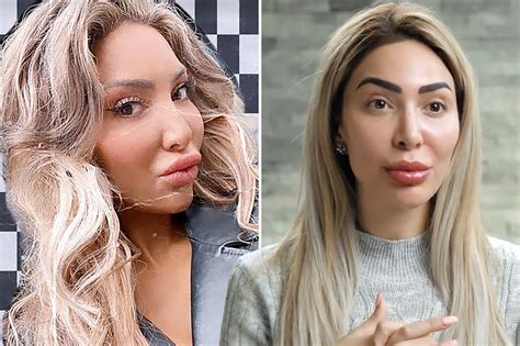 Teen Mom Farrah Abraham Shows Off Massive Lips After Her Face ‘appears To Droop’ In New Photos