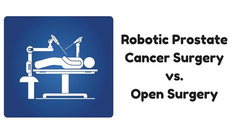 Prostate Cancer Robotic Vs Open Surgery Cancerwalls
