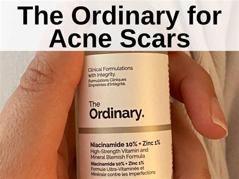 9 The Ordinary Products For Acne Scars 2023 Update