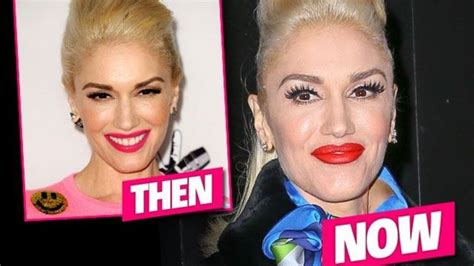 Before And After Images Of Gwen Stefani Plastic Surgery Major