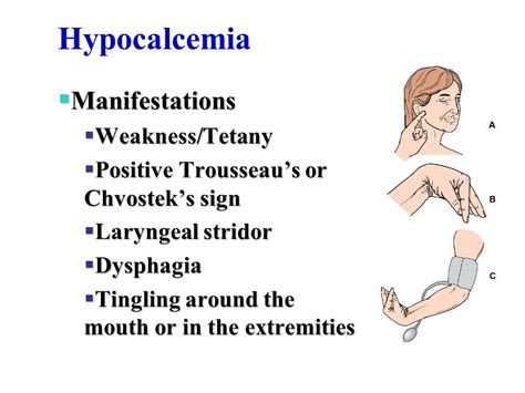An Arm And Wrist With The Words Hypocacemia On It Including