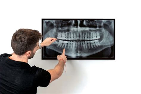 How Frequently Should You Get Oral Cancer Screenings Bitterroot