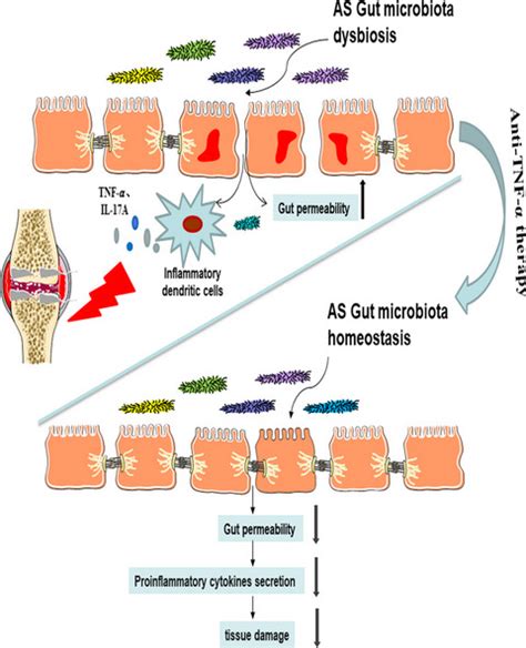 Anti‐tnf‐α Therapy Alters The Gut Microbiota In Proteoglycan‐induced