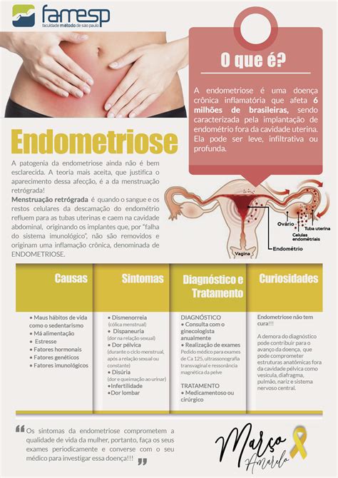 A endometriose é uma doença crônica que pode ser dolorosa. Endometriose afeta mais de 6 milhões de brasileiras | Famesp