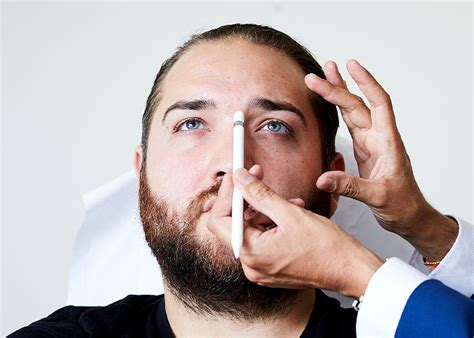 Misshapen Nose Treatment Bump On The Nose Time Clinic Essex