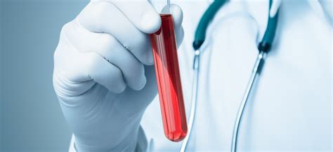 Nowe łatwe Badanie Krwi Wykrywa Ponad 50 Typów Raka