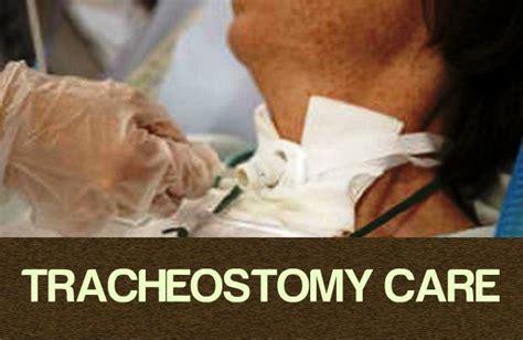 Tracheostomy Care Techniques For Nurses Nursebuff Tracheostomy Care Tracheostomy Nurse